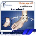 آرتروسکوپی مچ پا