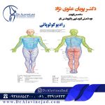 رادیوکولوپاتی