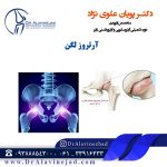 آرتروز لگن
