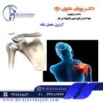 آرتروز مفصل شانه