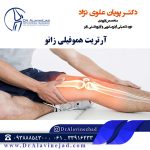 آرتریت هموفیلی زانو