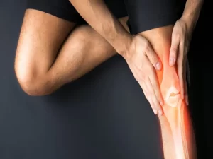 سینوویال کندروماتوزیس