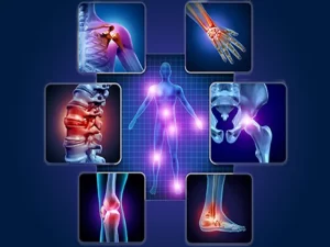 علائم و علل آرتروز
